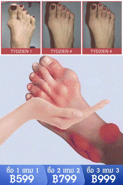 【บรรเทาอาการปวด 4 เท่า】 เจลกลูโคซามีน คอนโดรอิติน สำหรับแก้ปวดข้อ