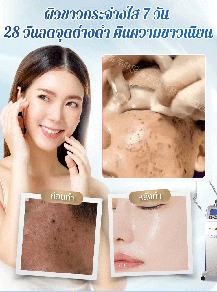 【ทาปุ๊บลดจุดด่างดำ】ครีมยูเรียลดจุดด่างดำ