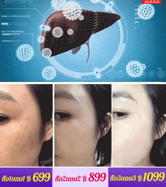 【ปกป้องตับและลดไขมัน】เม็ดเห็ดหลินจือรากคุดสุ
