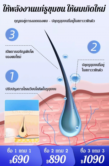 สเปรย์ปลูกผม บำรุงผมให้แข็งแรง