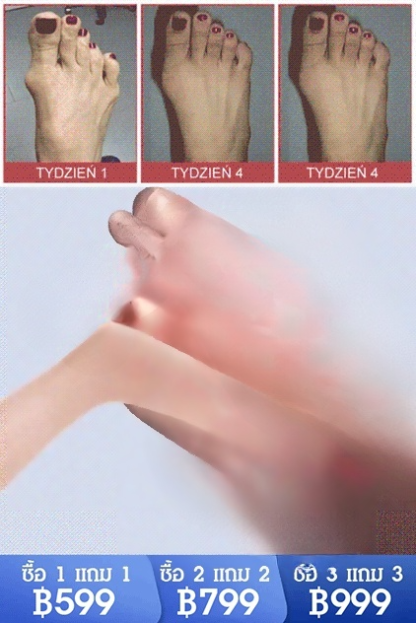 【บรรเทาอาการปวด 4 เท่า】 เจลกลูโคซามีน คอนโดรอิติน สำหรับแก้ปวดข้อ