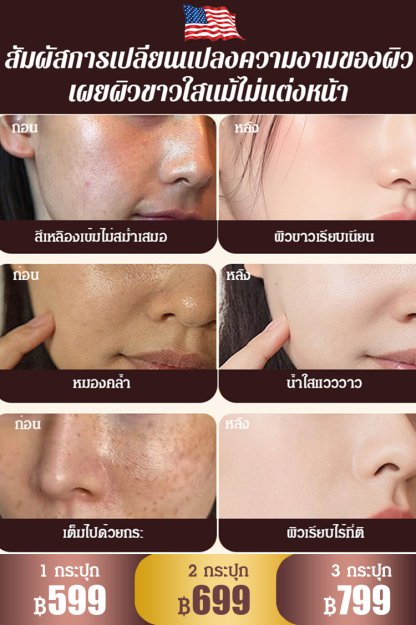 【มรดกร้อยปี】ครีมไวท์เทนนิ่งลดฝ้ากระ