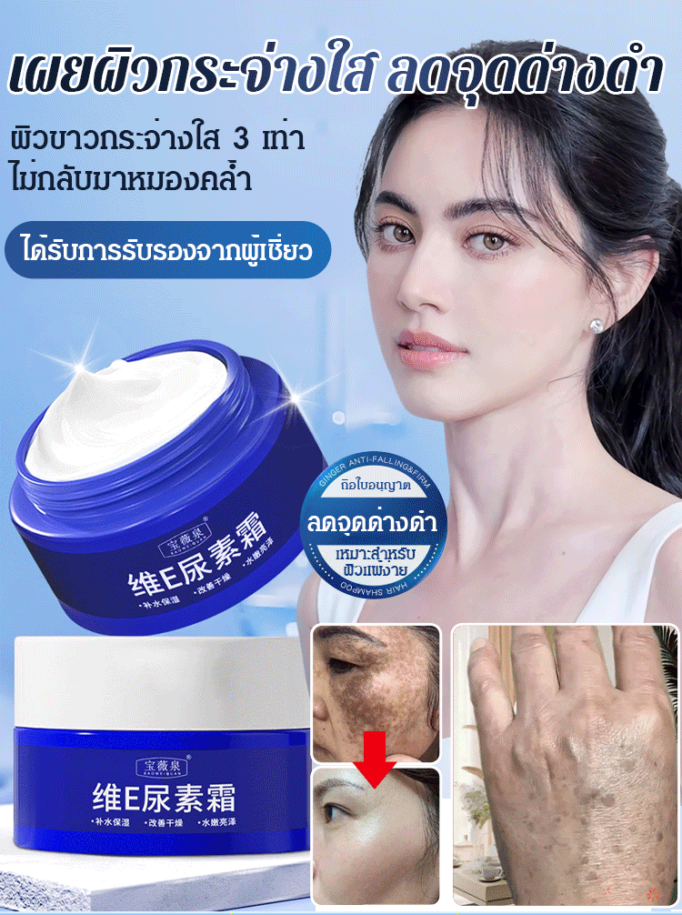 【ทาปุ๊บลดจุดด่างดำ】ครีมยูเรียลดจุดด่างดำ
