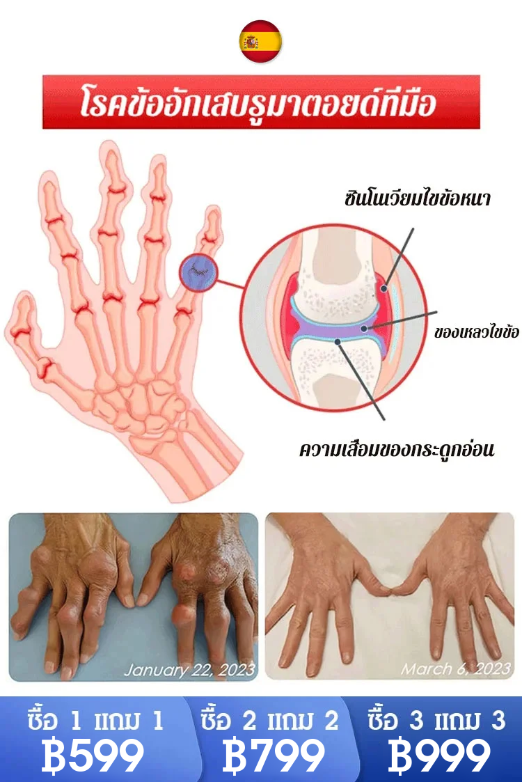 【บรรเทาอาการปวด 4 เท่า】 เจลกลูโคซามีน คอนโดรอิติน สำหรับแก้ปวดข้อ
