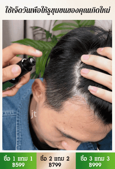 【สูตรปลูกผมสมุนไพรแบบโบราณร้อยปี】 เซรั่มพืชปลูกผมป้องกันผมร่วง