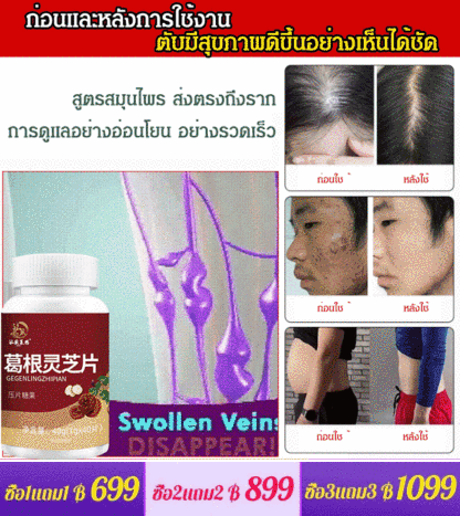 【ปกป้องตับและลดไขมัน】เม็ดเห็ดหลินจือรากคุดสุ
