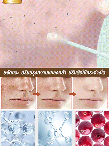 ครีมไวท์เทนนิ่งลดจุดด่างดำ