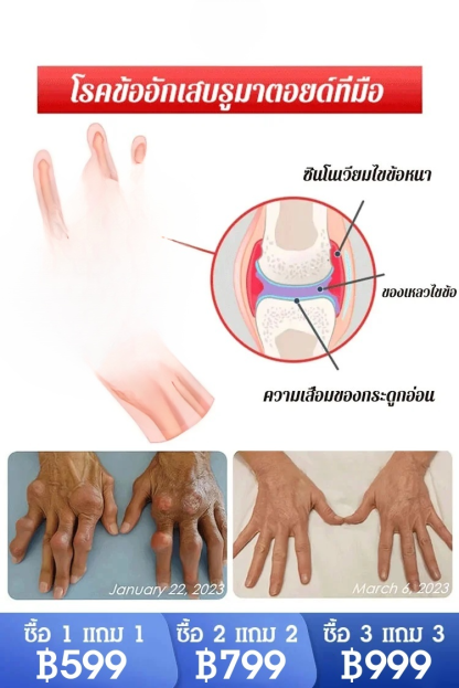 【บรรเทาอาการปวด 4 เท่า】 เจลกลูโคซามีน คอนโดรอิติน สำหรับแก้ปวดข้อ