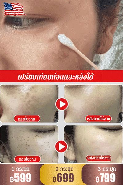 【มรดกร้อยปี】ครีมไวท์เทนนิ่งลดฝ้ากระ
