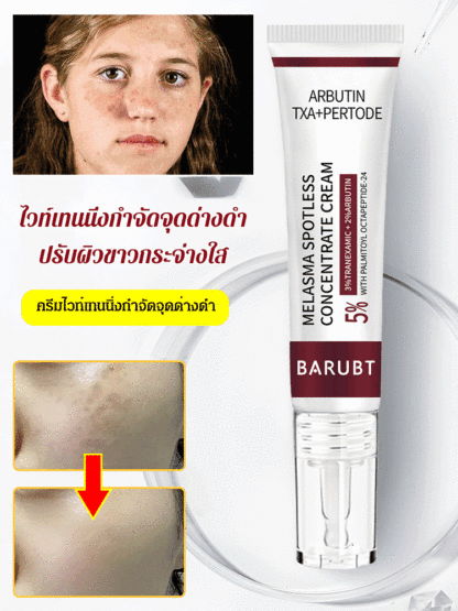 ครีมไวท์เทนนิ่งลดจุดด่างดำ