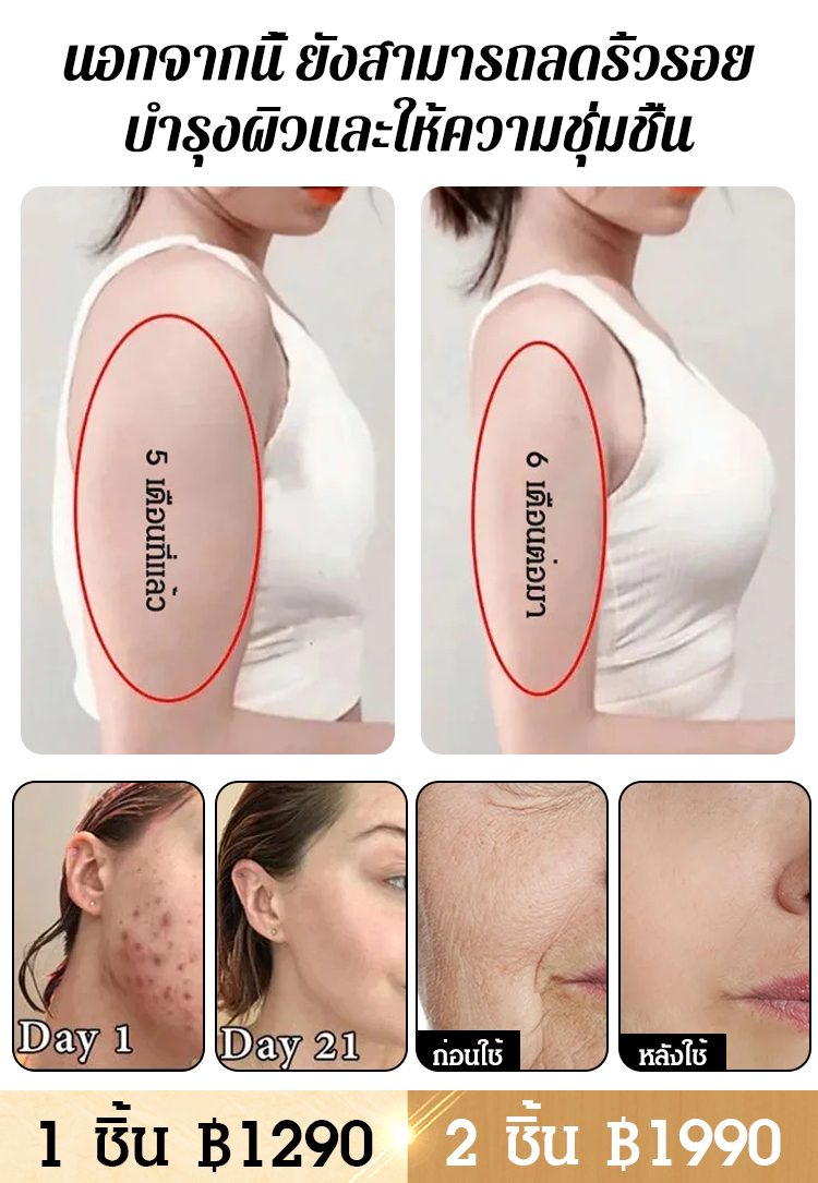 ถังแช่เท้า ทำความร้อนอัตโนมัติ อุณหภูมิคงที่ นวดเท้าได้