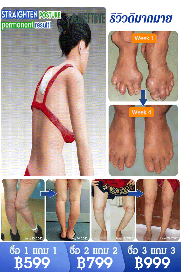 【บรรเทาอาการปวด 4 เท่า】 เจลกลูโคซามีน คอนโดรอิติน สำหรับแก้ปวดข้อ