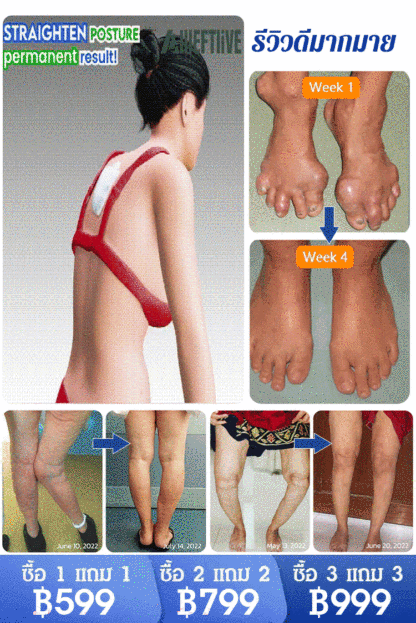 【บรรเทาอาการปวด 4 เท่า】 เจลกลูโคซามีน คอนโดรอิติน สำหรับแก้ปวดข้อ