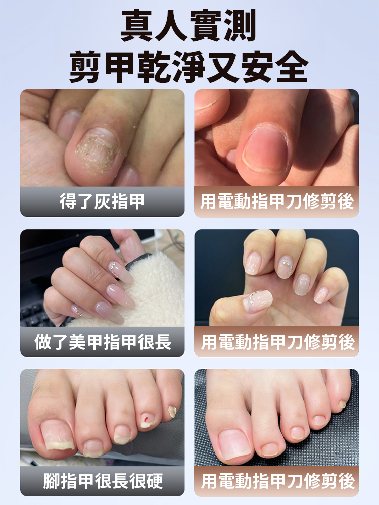 電動指甲刀