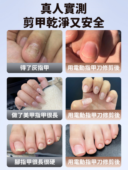 電動指甲刀