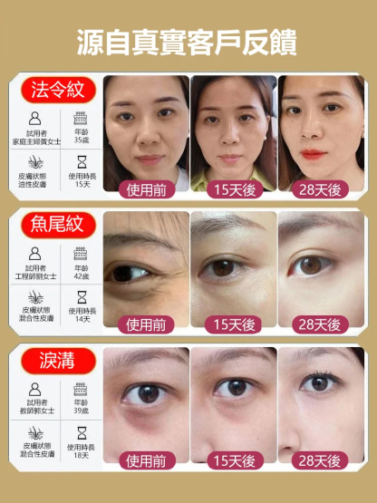 【深入底層肌膚】新款家用熱噴蒸臉器