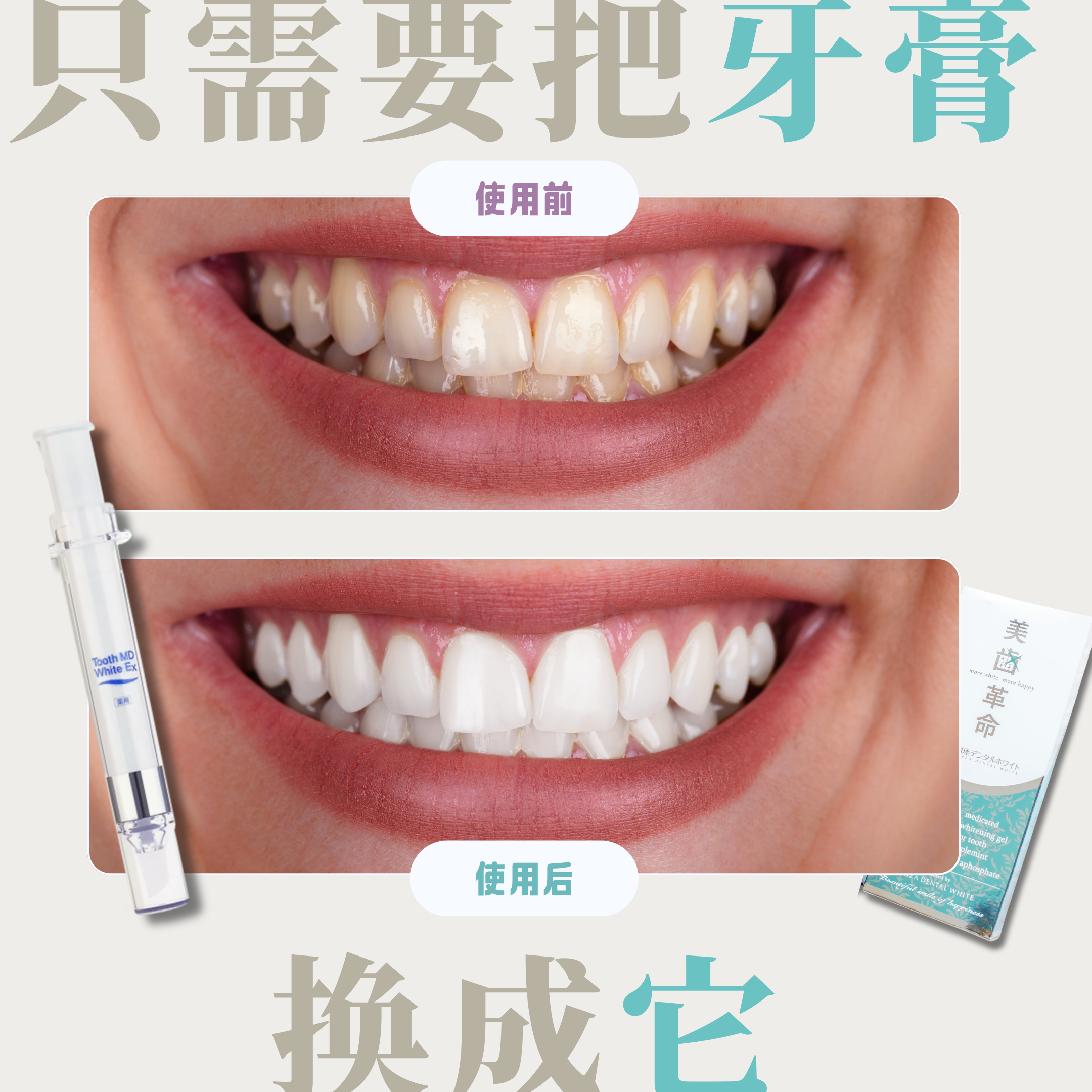 【日本牙醫診所推薦】牙齒美白革命！美白凝膠