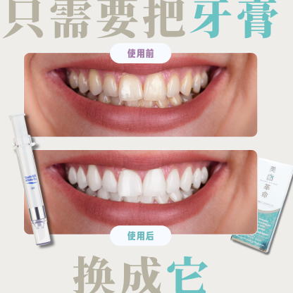 【日本牙醫診所推薦】牙齒美白革命！美白凝膠
