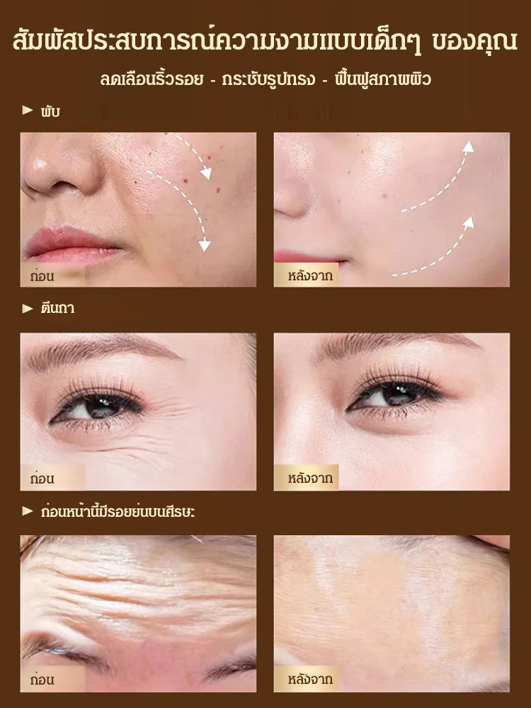 เซรั่มลดริ้วรอย Pro-Xylane