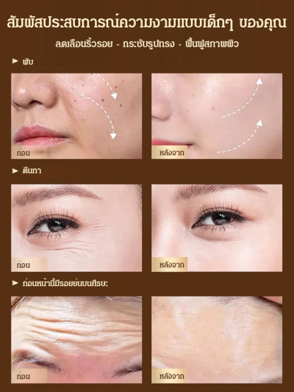 เซรั่มลดริ้วรอย Pro-Xylane