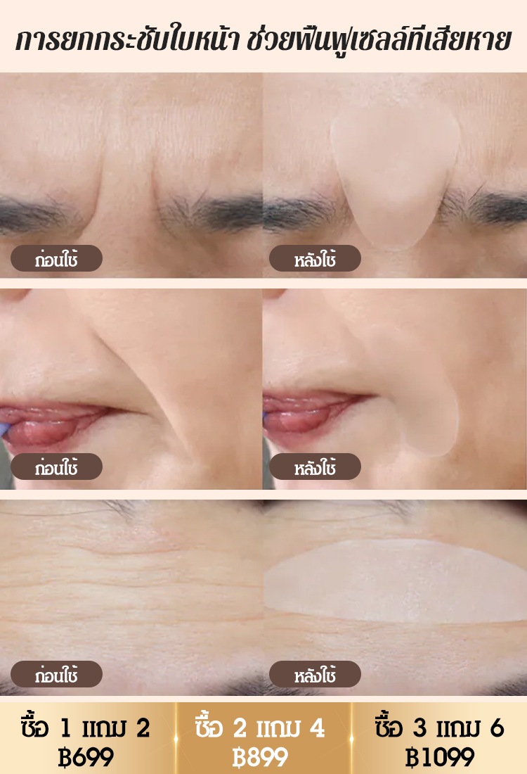 【ขายดีในเกาหลี】แผ่นแปะลดริ้วรอยโบท็อกซ์