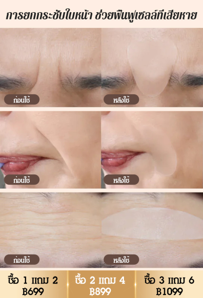 【ขายดีในเกาหลี】แผ่นแปะลดริ้วรอยโบท็อกซ์