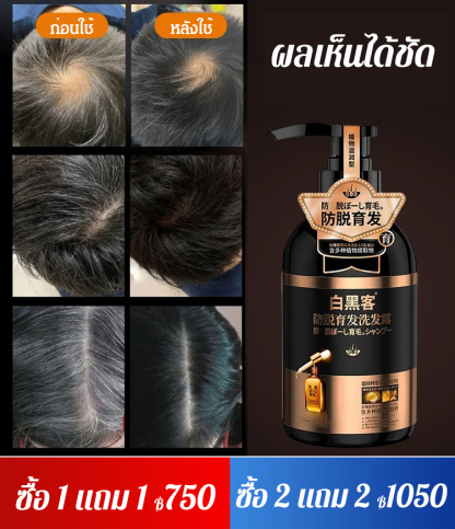 แชมพูลดผมร่วง ลดผมหงอก