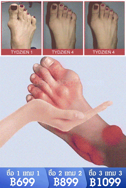 【บรรเทาอาการปวด 4 เท่า】 เจลกลูโคซามีน คอนโดรอิติน สำหรับแก้ปวดข้อ