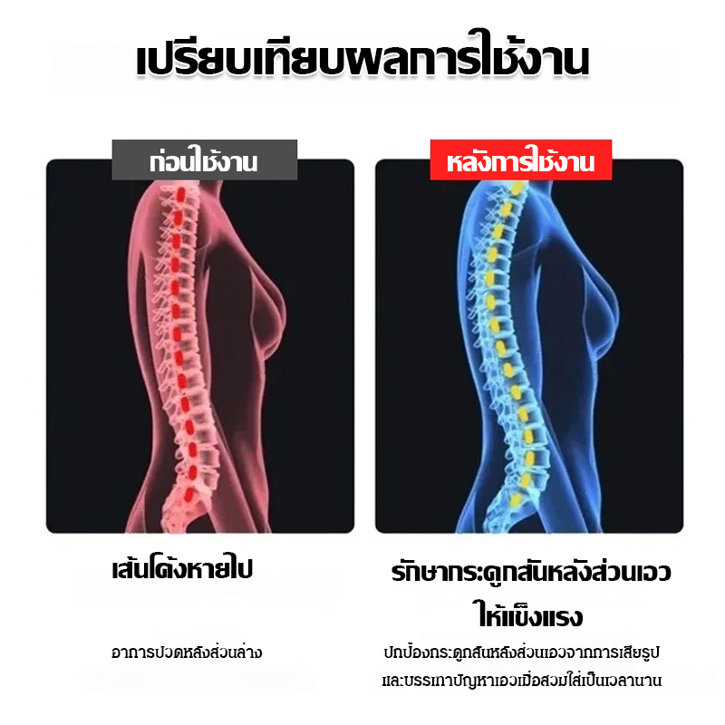 เข็มขัดแก้ไขอาการหลังค่อมที่จำเป็นสำหรับการดูแลร่างกาย