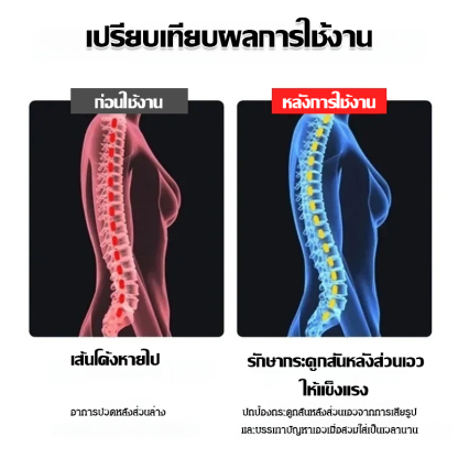 เข็มขัดแก้ไขอาการหลังค่อมที่จำเป็นสำหรับการดูแลร่างกาย