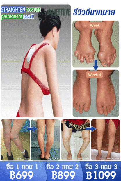 【บรรเทาอาการปวด 4 เท่า】 เจลกลูโคซามีน คอนโดรอิติน สำหรับแก้ปวดข้อ