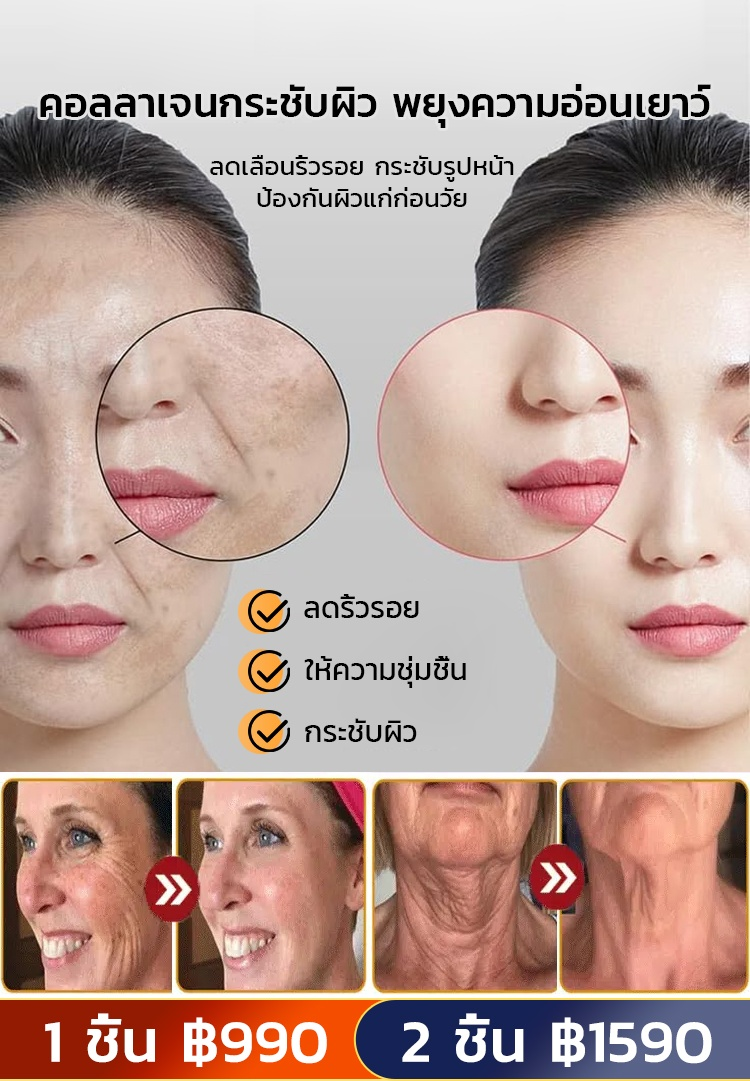 【รับส่วนลด จำกัดจำนวน 100 เครื่อง】เครื่องยกกระชับใบหน้าทรงพลัง ได้รูปหน้า V เล็กๆ ง่ายๆ พร้อมยกกระชับผิว✨