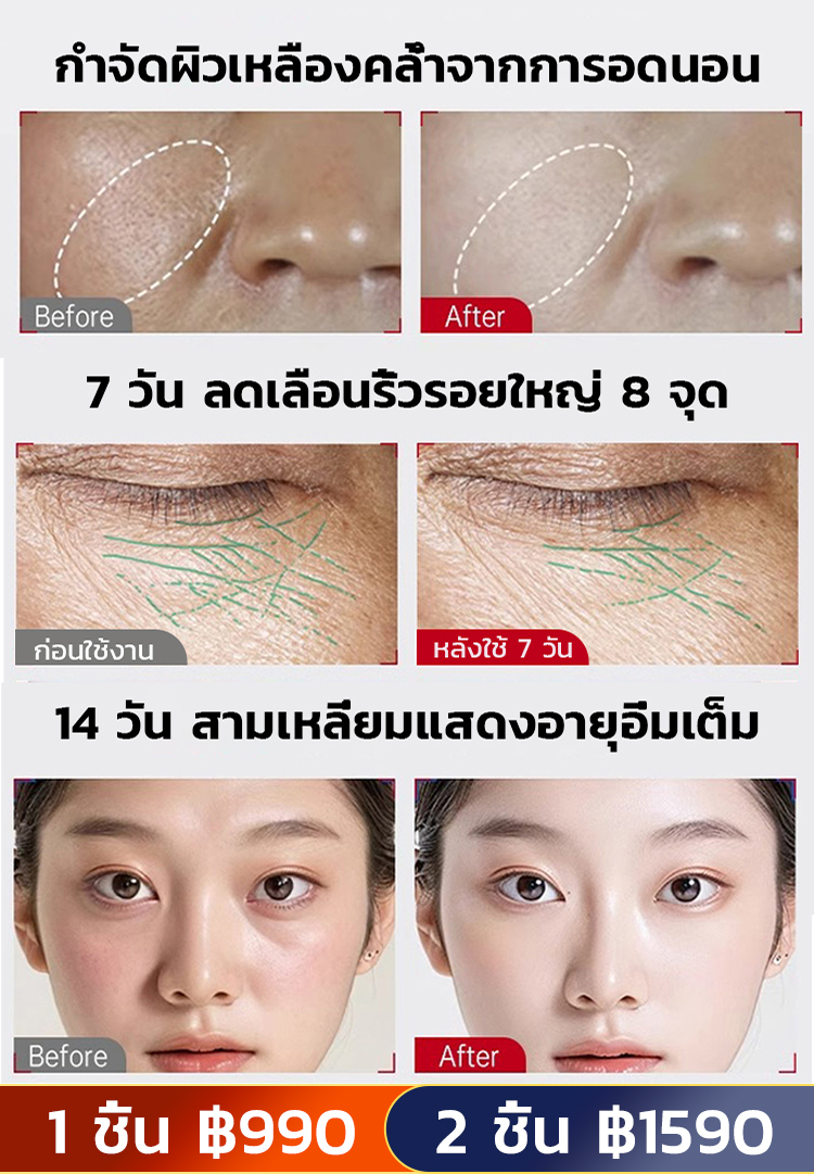 【รับส่วนลด จำกัดจำนวน 100 เครื่อง】เครื่องยกกระชับใบหน้าทรงพลัง ได้รูปหน้า V เล็กๆ ง่ายๆ พร้อมยกกระชับผิว✨