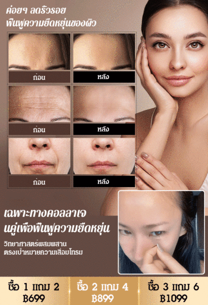 【ขายดีในเกาหลี】แผ่นแปะลดริ้วรอยโบท็อกซ์