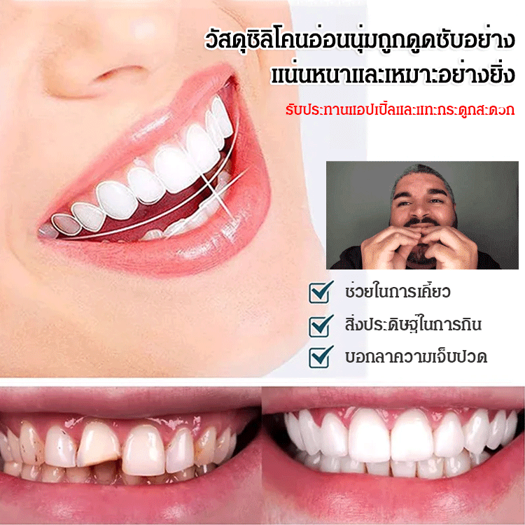 ฟันปลอมรอยยิ้มสวยงาม SorriBem 