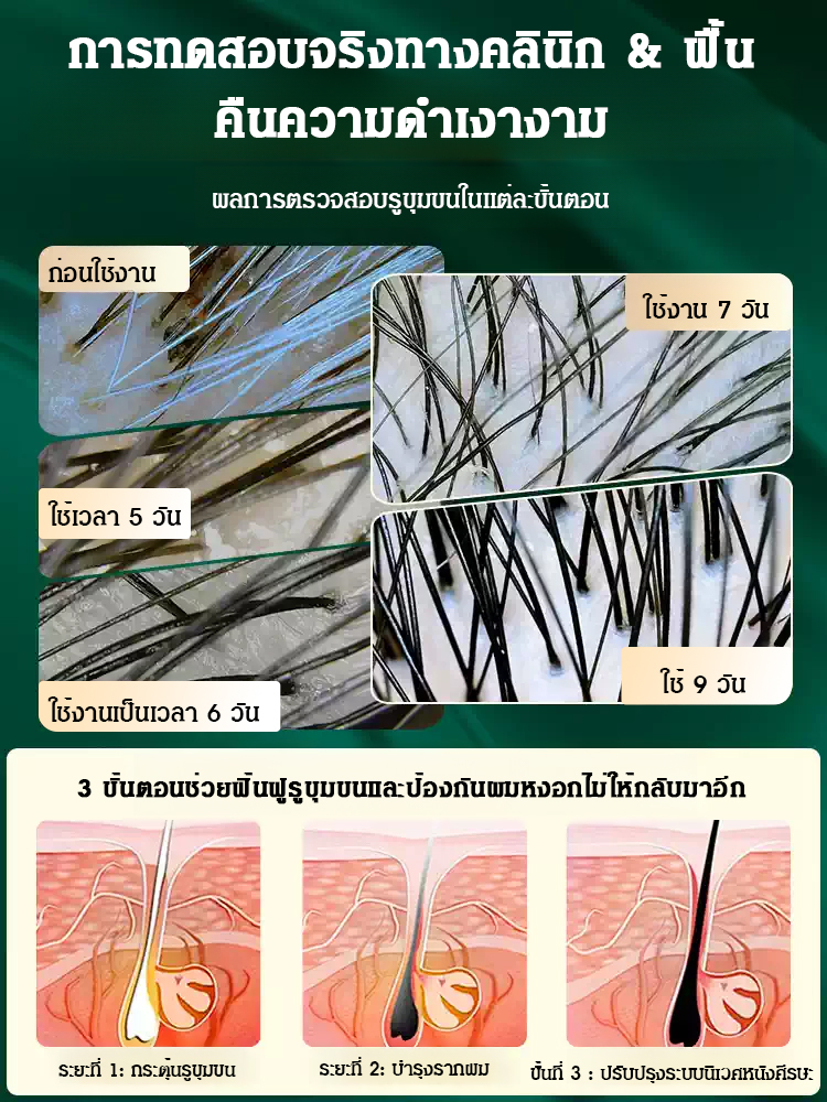 【ไวท์แฮร์ แคร์ แบล็ค】สเปรย์น้ำมันบำรุงผม ไม่ต้องย้อมผมหงอกก็ผมดำหนาได้