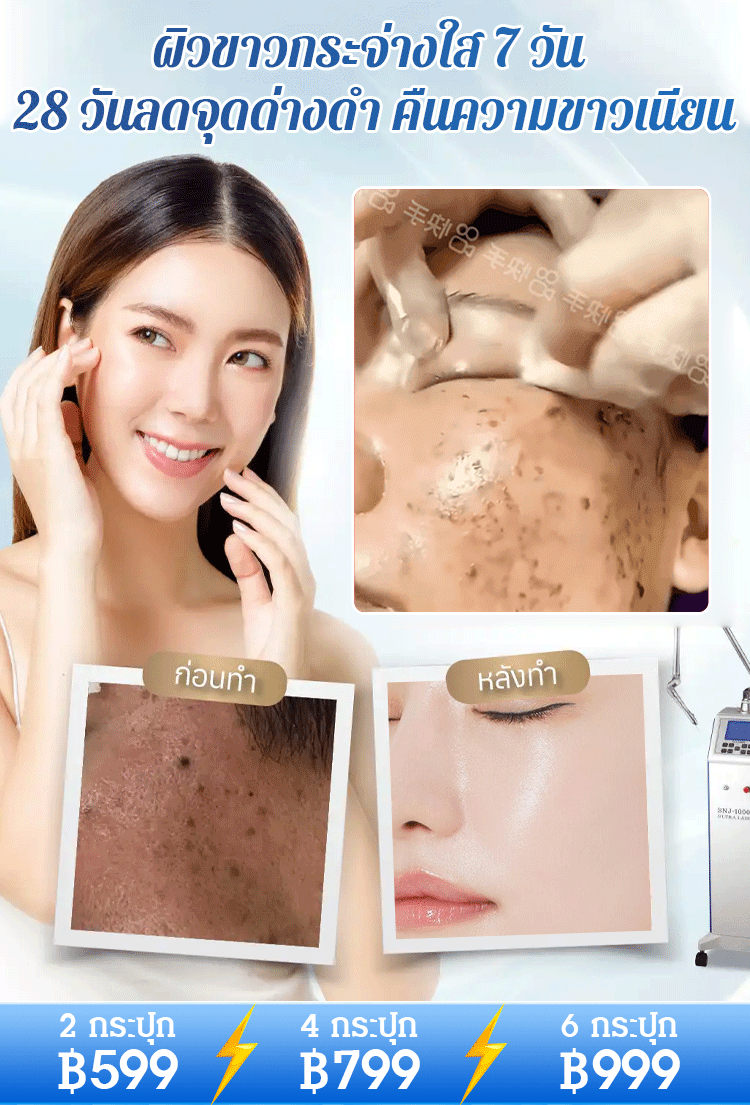 【ทาปุ๊บลดจุดด่างดำ】ครีมยูเรียลดจุดด่างดำ 