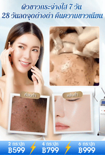【ทาปุ๊บลดจุดด่างดำ】ครีมยูเรียลดจุดด่างดำ 