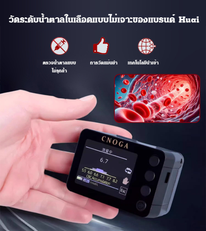 เครื่องวัดออกซิเจนในเลือดทางการแพทย์ ตรวจน้ำตาลในเลือดแบบไม่เจ็บปวด ติดตามสุขภาพของคุณตลอด 24 ชั่วโมง