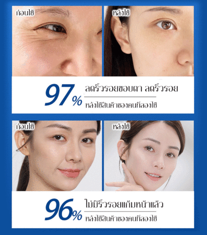 เทคโนโลยีญี่ปุ่น ครีมต่อต้านริ้วรอยให้ความชื้น แตะครั้งเดียว ผิวดูอ่อนเยาว์ลง 20 ปี!🌟