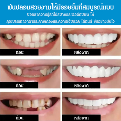 ฟันปลอมรอยยิ้มสวยงาม SorriBem 