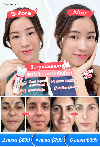 【ลดจุดด่างดำ】ครีมลดฝ้าบำรุงผิวขาวใสสดชื่น
