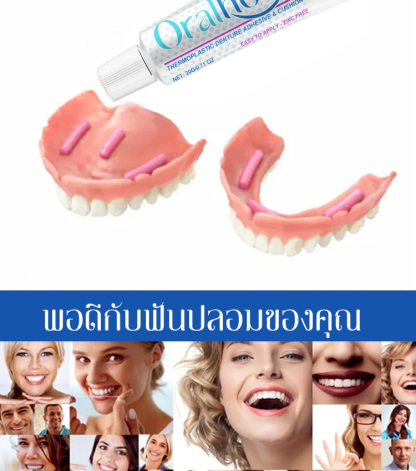 กาวติดฟันปลอมเกรดอาหารสร้างรูปด้วยความร้อน