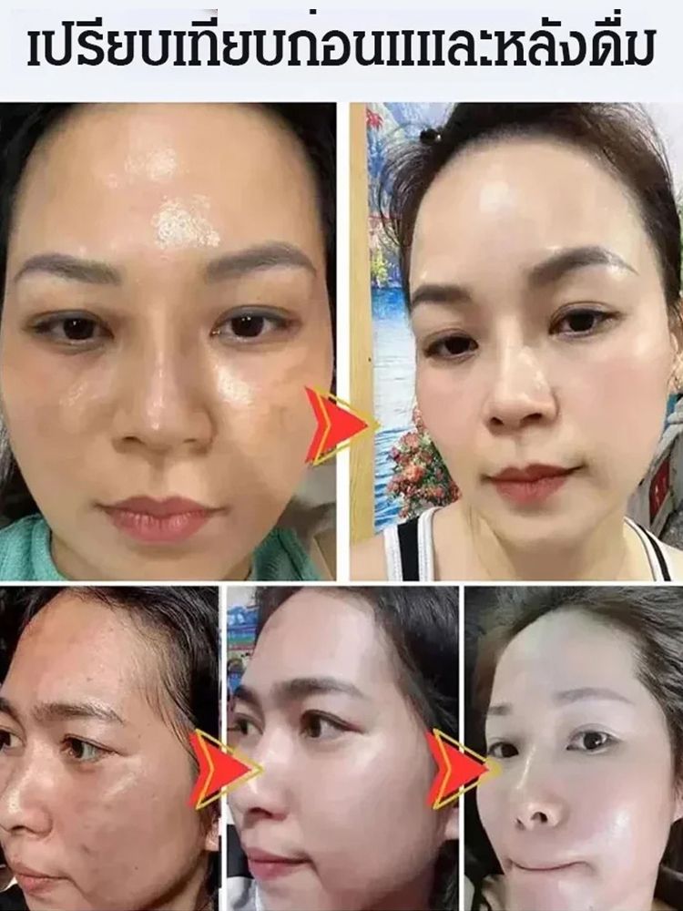 [บำรุงผิวพรรณ] ผงบีทรูทโฟเลตธาตุเหล็ก รสเปรี้ยวอมหวาน ผิวพรรณดี
