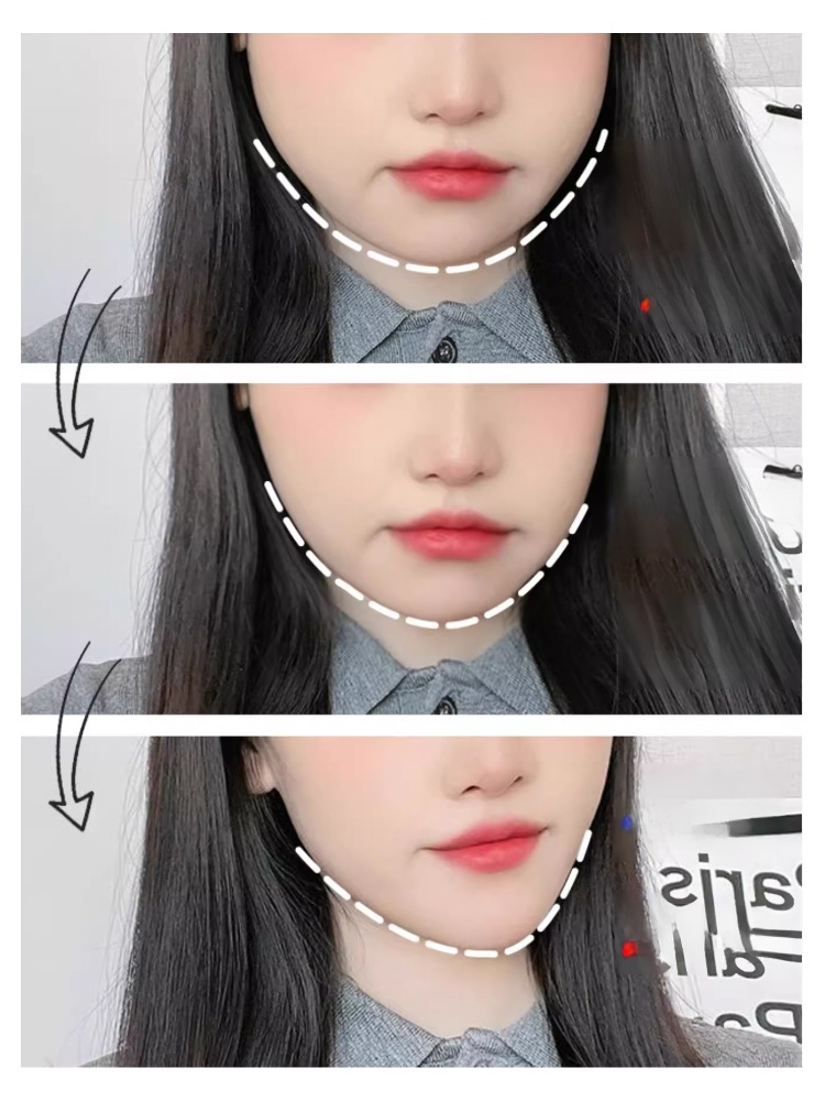 【หน้าทรงวีเล็กใน 1 สัปดาห์】เครื่องกระชับหน้าเรียวความถี่สูง