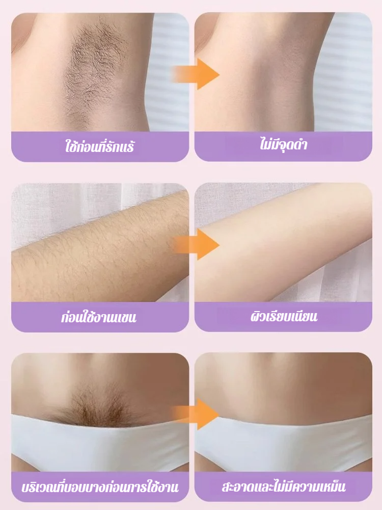 เครื่องโกนหนวดส่วนตัวของผู้หญิง เครื่องโกนหนวดไฟฟ้าหัวคู่