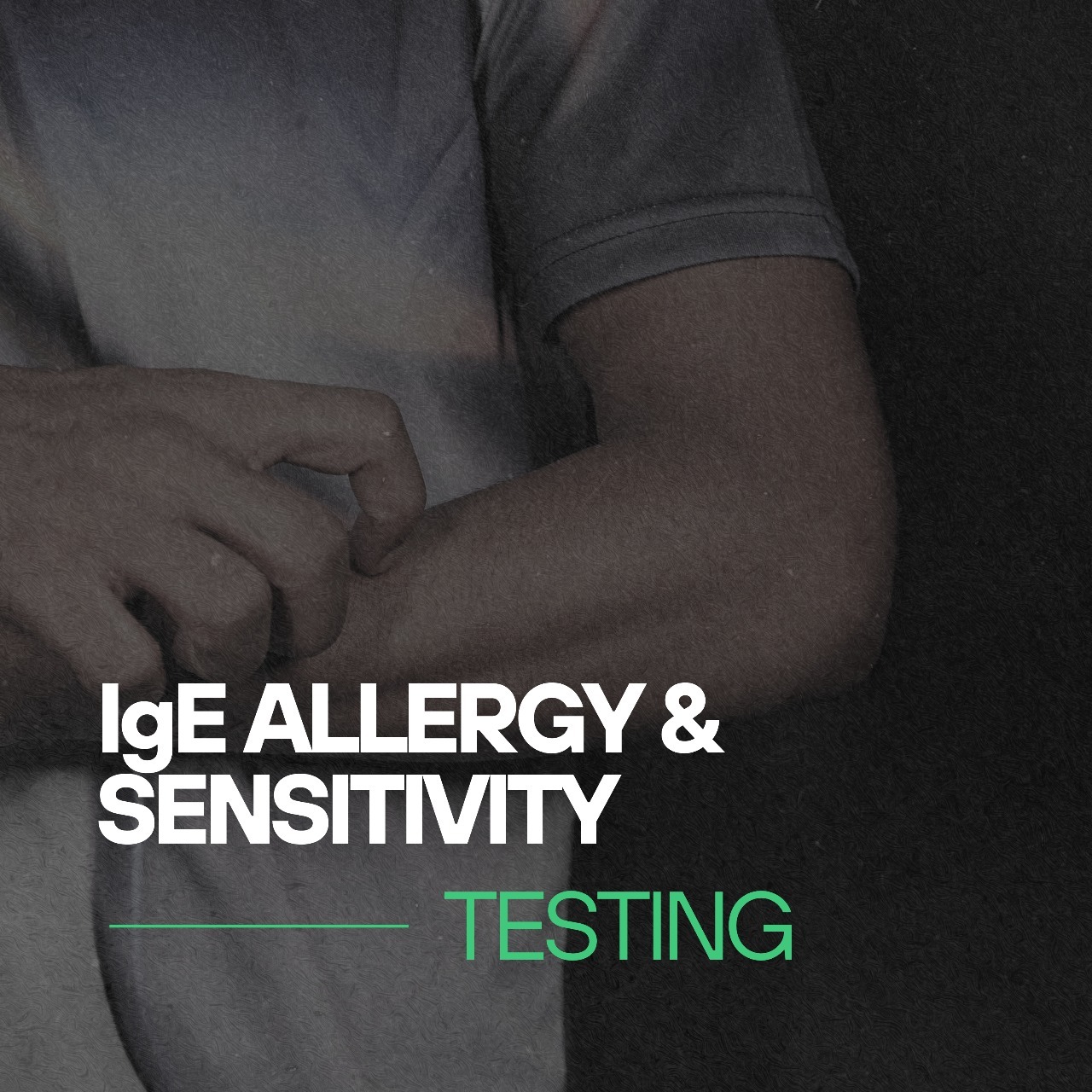 IgE Allergy Panel – 57 Antigens