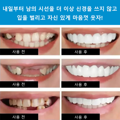 3M™ 유니텍™ 교정 치과용 제품