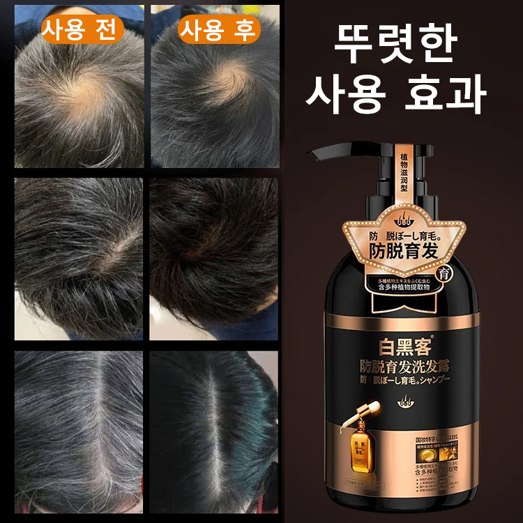 하수오 탈모 방지 및 모발 케어 샴푸,💥대폭 할인,  2+2, 47,900원💥다양한 식물 추출물이 함유되어 있으며, 탈모 방지, 발모, 기름 제거 효과가 있습니다.