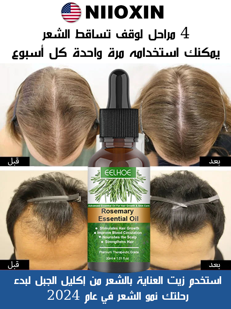 زيت عطري من  مستخلصات إكليل  الجبل لتعزيز نمو الشعر